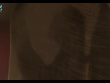 [Feilin嗲囡囡] NO.052 张俊佳